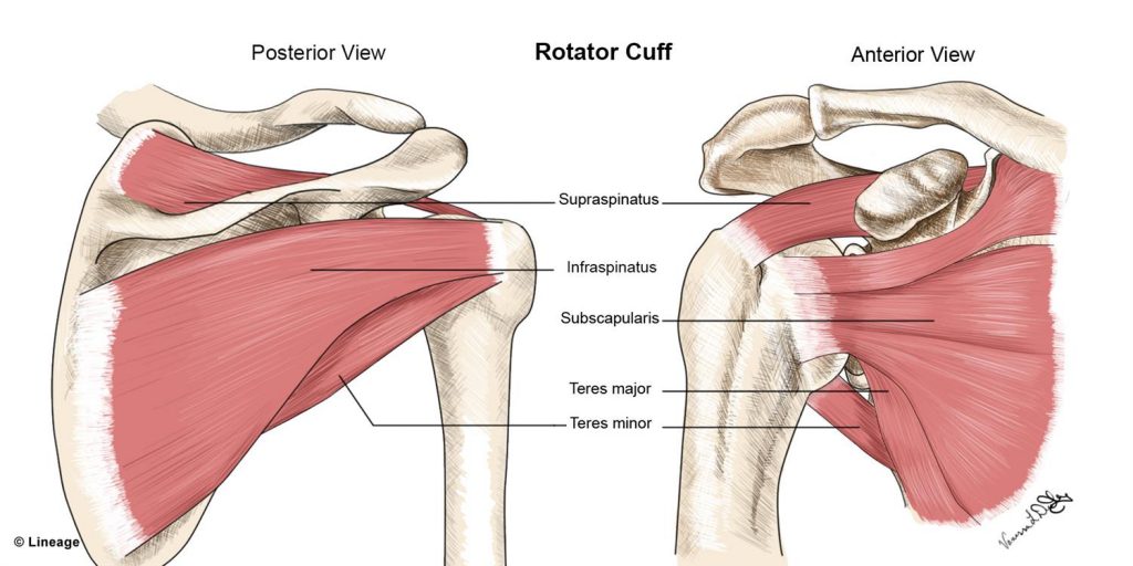 full rotator cuff tear